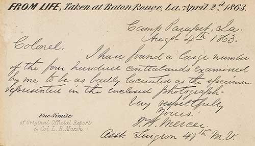 Text on the reverse of scarred slave photo