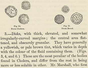 Detail from a book investigating the cell structure of cholera