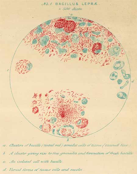 Illustration of leprosy bacteria in a petridish