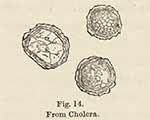 Illustration of three cholera cells